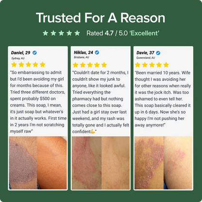 Veloma Antifungal Soap